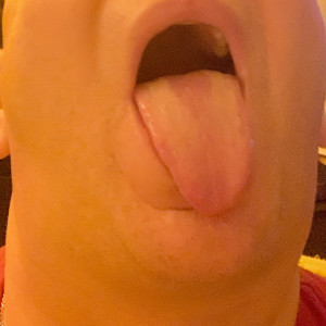 Otwór na spermę i szczyny