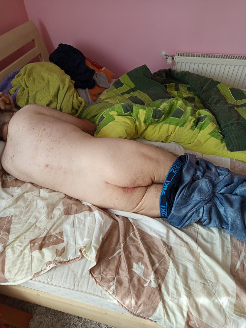 Od urodzenia choruje na mózgowe porazenie Szukam Atywa do seksu bez wzajemność tylko w jedną strone .